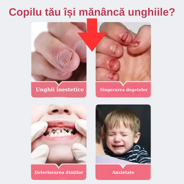 Tratament - Stop Rontait Unghii