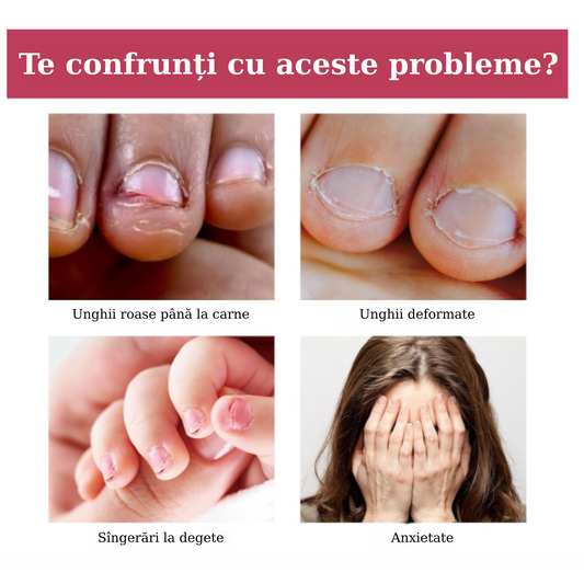 Tratament - Stop Rontait Unghii